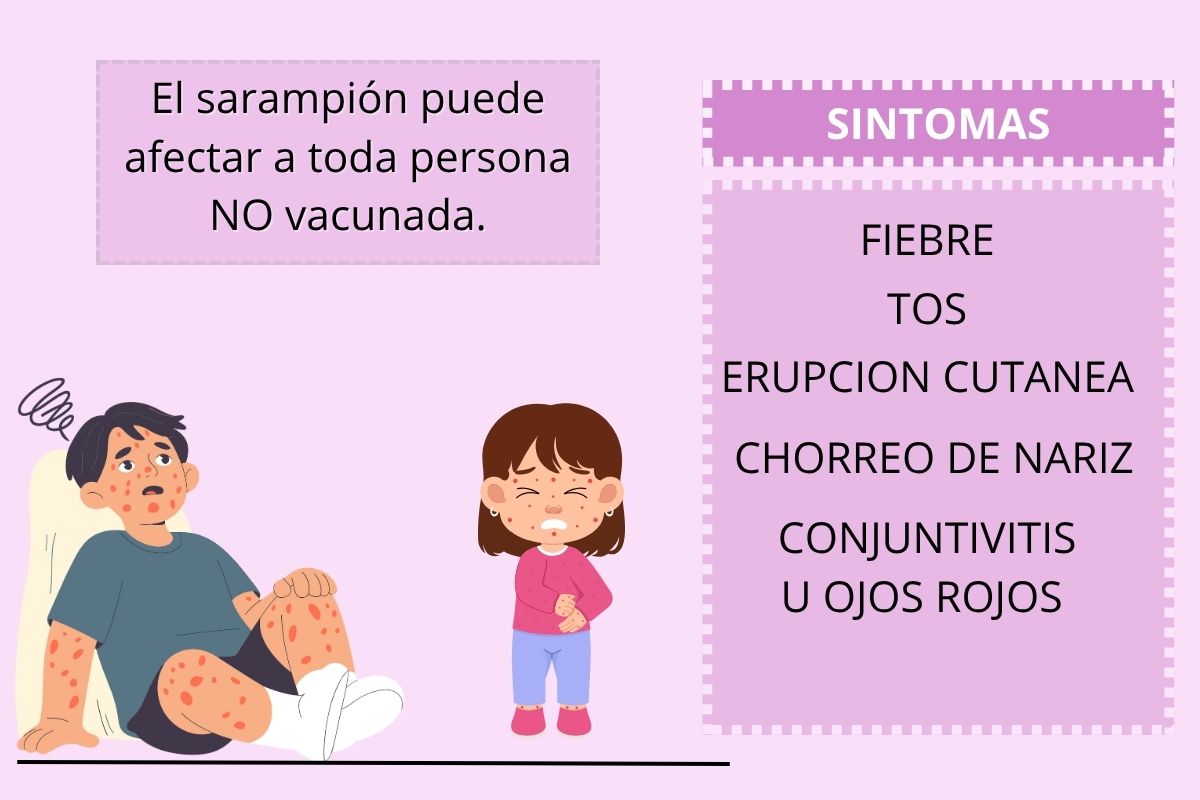 brote de sarampion